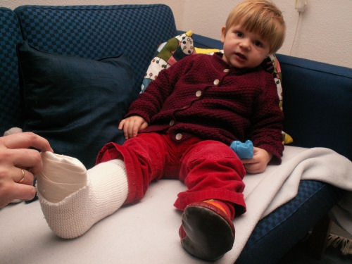 Ida med foden i gips efter et uheldigt fald i Vuggestuen! Siden dette billede blev taget er gipsen blevet lagt om to gange, da man på skadestuen tilsyneladende havde glemt at tage højde for, at børn på to år godt kan finde på at bevæge sig lidt i løbet af 14 dage ...!